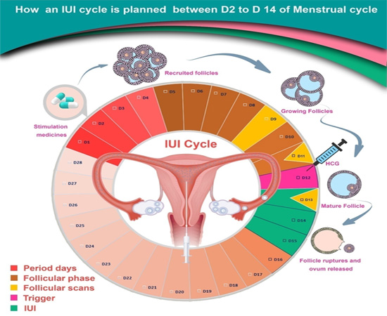iui treatment from the best iui clinic in kolkata how insemination works